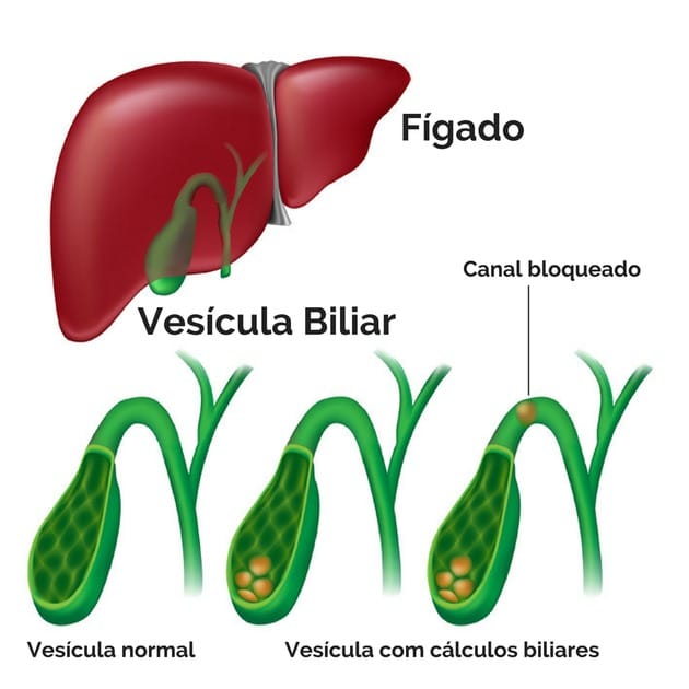 vesícula biliar