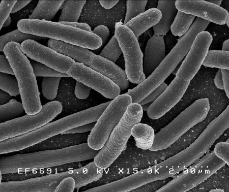Escherichia coli.  Foto: NIAID / NIH