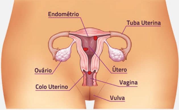 Ubicación de los ovarios