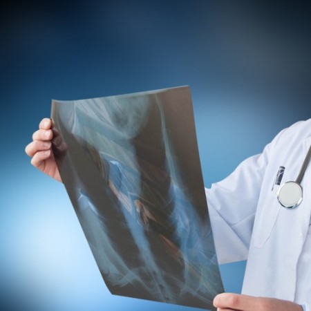 Doctor examinando una radiografía.  Foto: MorganStudio / Shutterstock.com