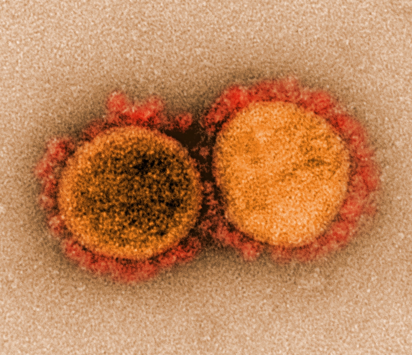 Prevención del COVID-19 – como evitar el nuevo coronavirus – Salud