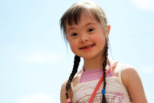 Niña con síndrome de Down.  Foto: Denis Kuvaev / Shutterstock.com
