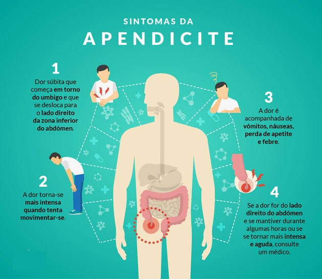 síntomas de apendicitis