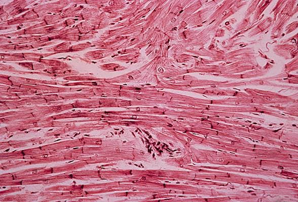 Células del músculo del miocardio